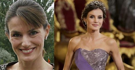 Video Del Antes Y Después Evidenciaría Cirugías Que La Reina Letizia Se