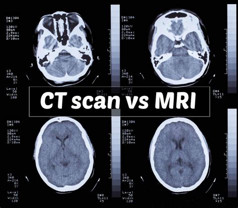 Ct Vs Mri Understanding The Differences Kings Medical Group