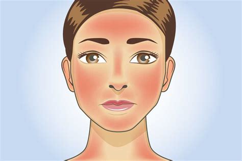 How To Treat Skin Redness Erythema 10 Common Causes Of Redness