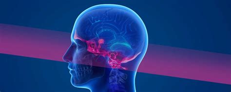 Complex Skull Base Tumors Symptoms And Treatment Polaris