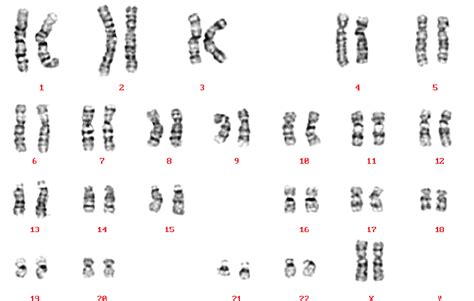 A Karyotype Of A Normal Female Xx Reproduced Courtesy Of Human