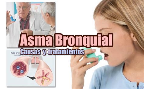 Asma bronquial Síntomas Causas y Tratamiento