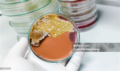 Colonies Of Candida Albicans Growth On Chocolate Agar High Res Stock