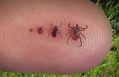 Research Shows Lyme Disease Under Detected Across Canada The Star