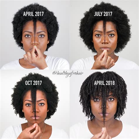 Talk to your doctor about medications. 1 Year Natural Hair Growth Comparison - Black Hair Information