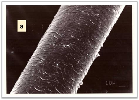 Hair Structure A Hair Cuticle Consisting Of Thin Keratinized Scales