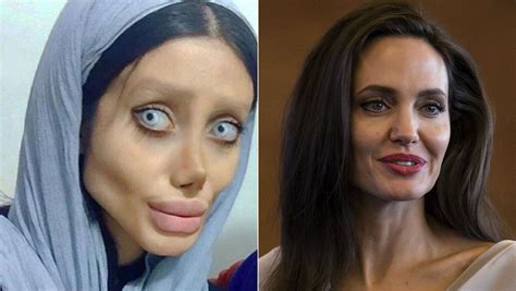 Sahar Tabar Femeia Care S A Operat Să Arate Precum Angelina Jolie și A Arătat Adevărata Față