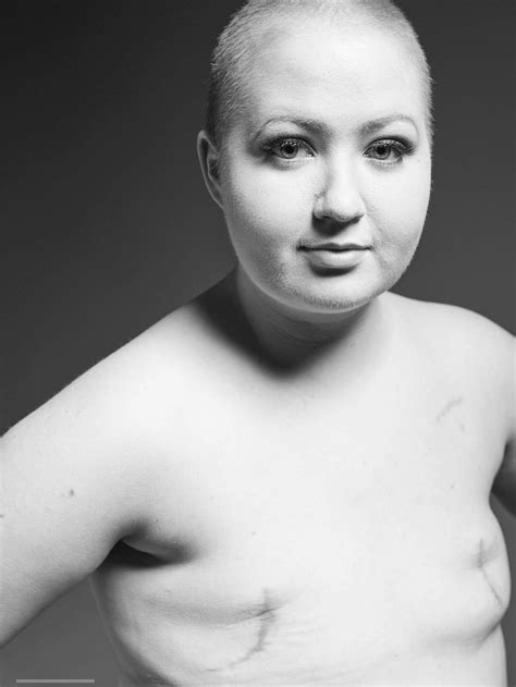 Tasmanian Breast Cancer Survivor Challenges Views With Photo Shoot After Double Mastectomy Abc