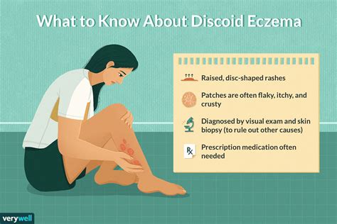 Discoid Eczema Symptoms Causes Diagnosis Treatment And Coping