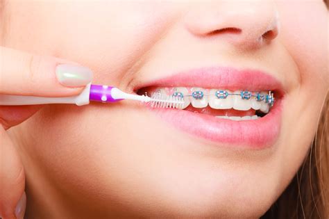 woman brushing teeth with braces using brush valderrama orthodontics