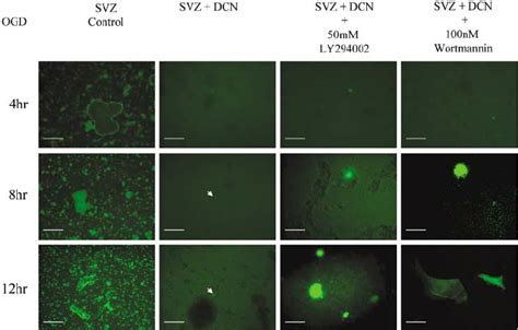 Mouse Subventricular Zone Svz Cells Are Protected From Apoptosis By