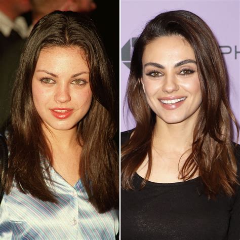 Did Mila Kunis Get Plastic Surgery Then And Now Photos Life And Style