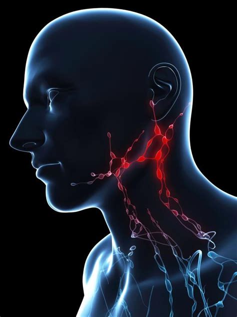 Swollen Glands Lymph Glands Lymph Nodes Lymph Node Cancer