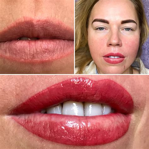 All 102 Images Before And After Permanent Lip Color For Dark Lips Superb