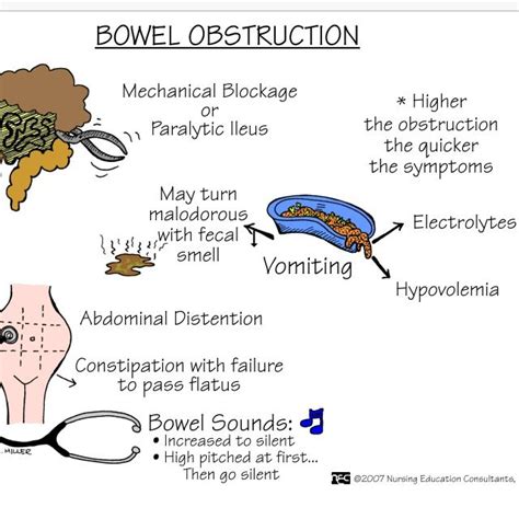 An Image Of The Different Types Of Bowel Obstructions And Their Functions