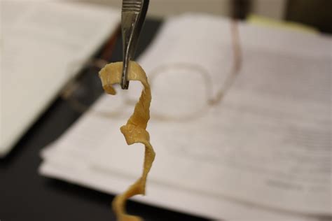Tapeworm Specimen From Zoology Lab Today Louis Shackleton Flickr
