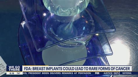 Breast Implants Could Lead To Rare Forms Of Cancer Fda Says Youtube