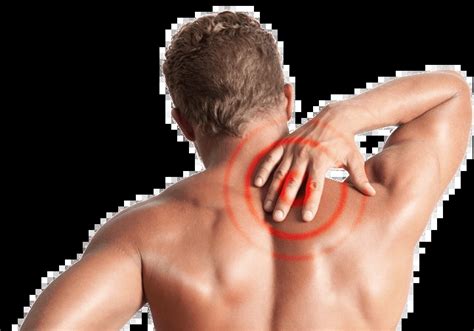 Pinched Nerve In Neck Symptoms Causes Treatment And More Vlrengbr