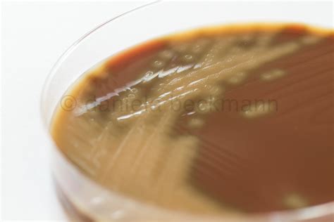 Streptococcus Pneumoniae On Chocolate Agar A Photo On Flickriver