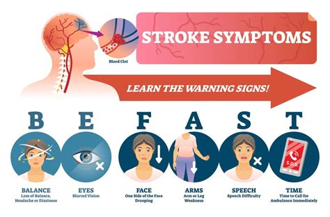 Stroke Symptoms And Prevention