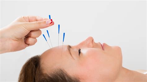 The Benefits Of Acupuncture For Chronic Fatigue Syndrome Steve Bailey