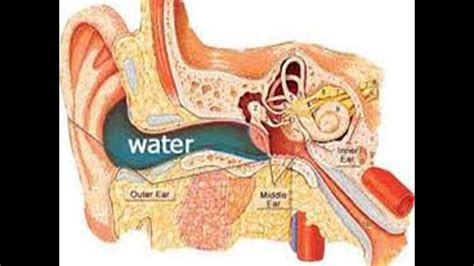 What Are Happen After Shower If Water Stay In Your Ears Drfoheid