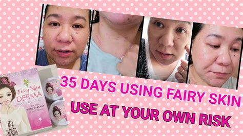 My 35 Days Experience And Honest Detailed Review Of Fairy Skin Derma