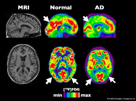 Brain Scan