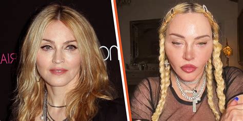 What Did Madonna Do To Her Face The 63 Year Old Singer Looks Youthful