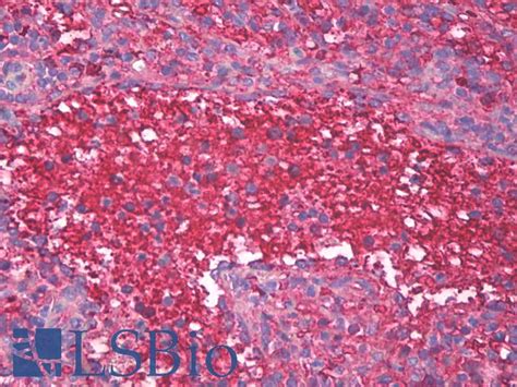 Ihc Plus™ Plasma Cell Monoclonal Antibody Mouse Anti Human Ihc Lsbio