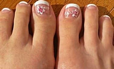 Is toenail removal covered by insurance. Should You Use Acrylic or Fake Toenails to Cover Fungus?