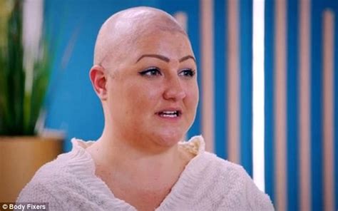 Bald Mother On Body Fixers Hasn T Had A Date In Six Years Daily Mail Online