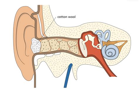 How Do You Perform A Tympanoplasty — Ent4kids