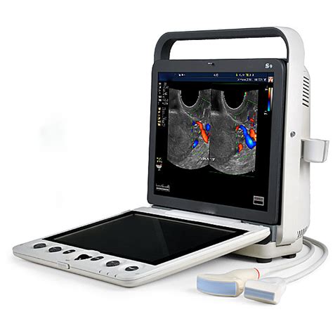 Sonoscape S9 Portable Echocardiography Handheld Cardiac Ultrasound