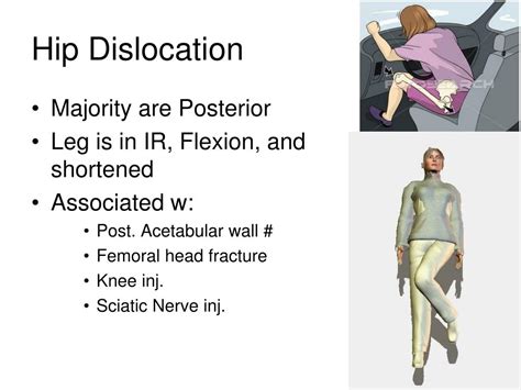 Ppt Orthopedics In Er Powerpoint Presentation Free Download Id5405749