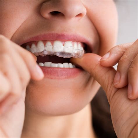 How To Make Changes On Your Teeth Alignment As An Adult Clear Smiles