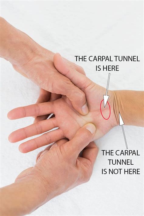 The Location Of The Carpal Tunnel Carpal Tunnel Remedies Carpal Tunnel