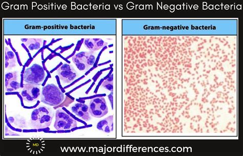 Difference Between Gram Positive And Gram Negative Bacteria Md