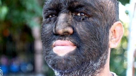 Only a strip in the center will be left. Meet the World's Hairiest Man - YouTube