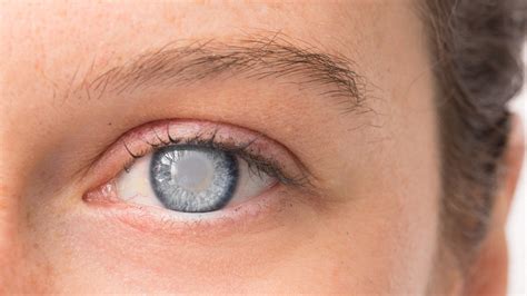 How To Identify Glaucoma In The Early Stages