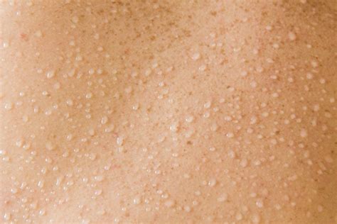 Skin Problems That Could Be A Sign Of Serious Disease The Healthy