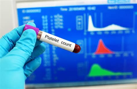 Understanding Platelet Count Normal Range Low And High Platelet