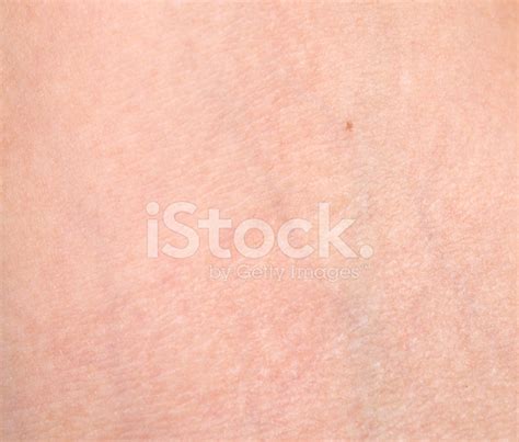 Melanoma Skin Cancer Mole Stock Photo Royalty Free Freeimages