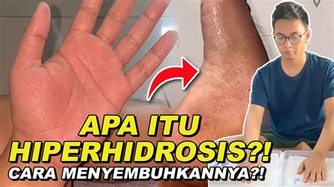 Tangan Jadi Sering Berkeringat Ini Solusi Hiperhidrosis Keringat