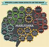 Long Term Effects Of Marijuana Use On The Brain Pictures