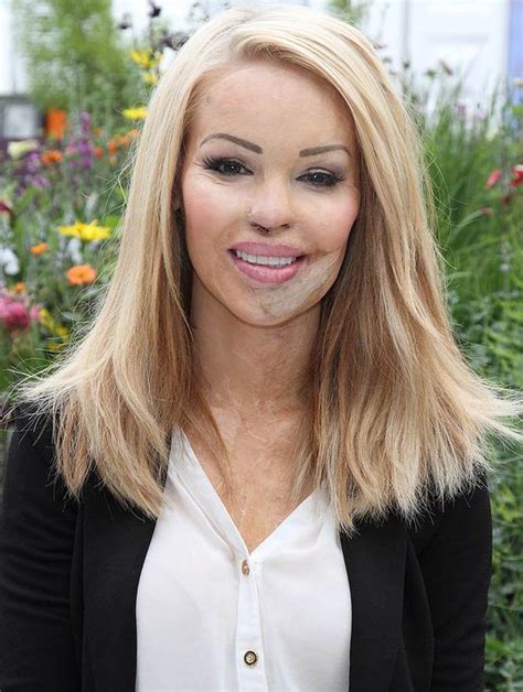 katie piper opens up about her struggle to find love after acid attack celebrity news