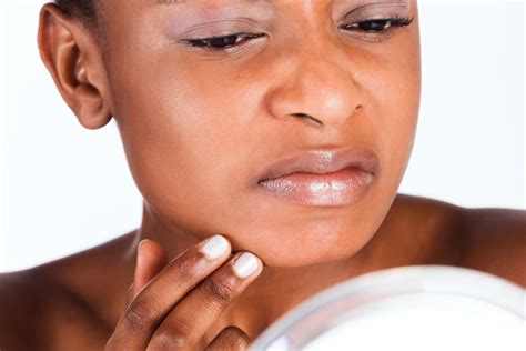 The Dangers Of Imported Skin Lightening Products