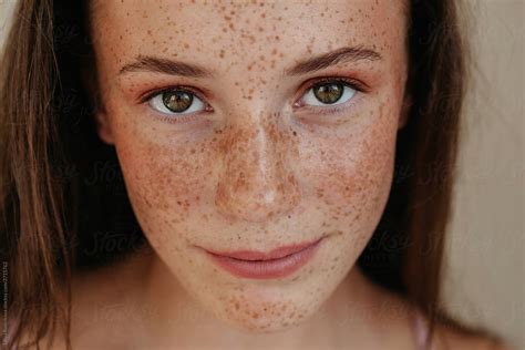 Freckles Portrait By Liliya Rodnikova