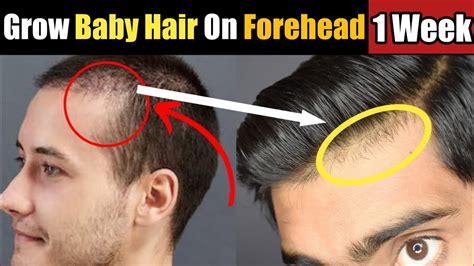 How To Grow Baby Hair On Forehead Fastly Shorts Stop Hairfall
