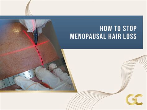 How To Stop Menopausal Hair Loss Gold City Best Hair Transplant Turkey